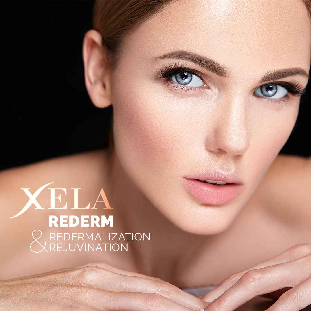 Xela Rederm