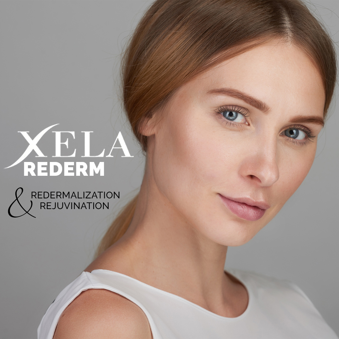 Xela Rederm