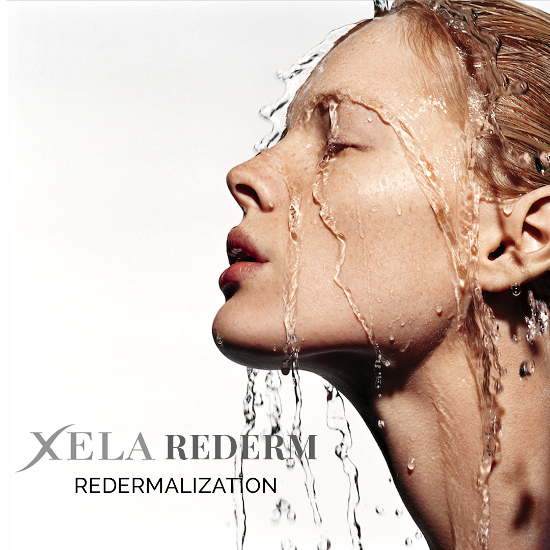 Xela Rederm