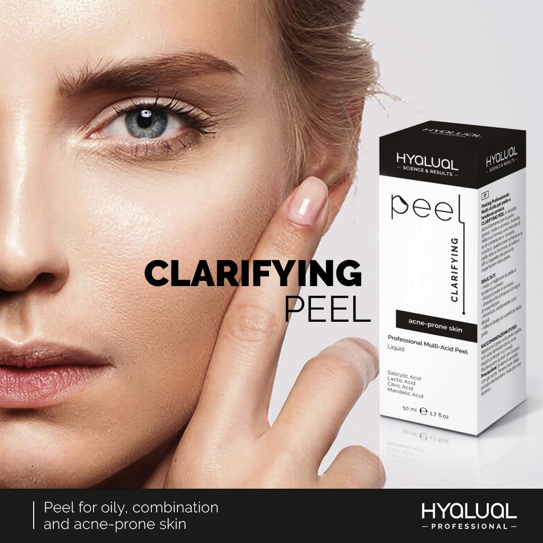 Clarifying Peel