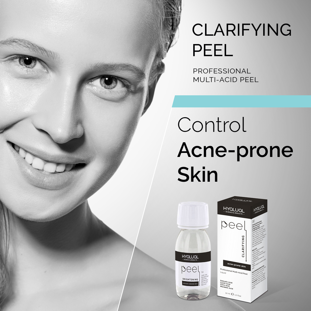 Clarifying PEEL