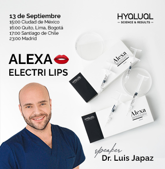 Alexa Electri Lips