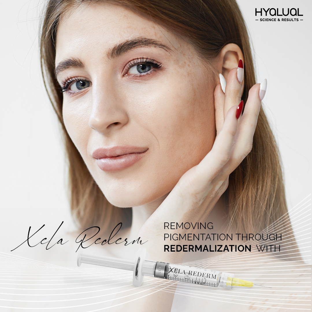Xela Rederm