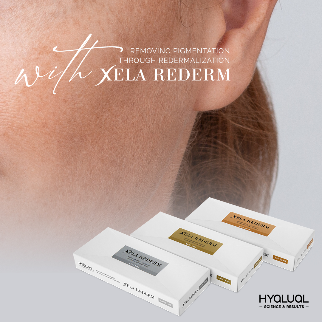Xela Rederm