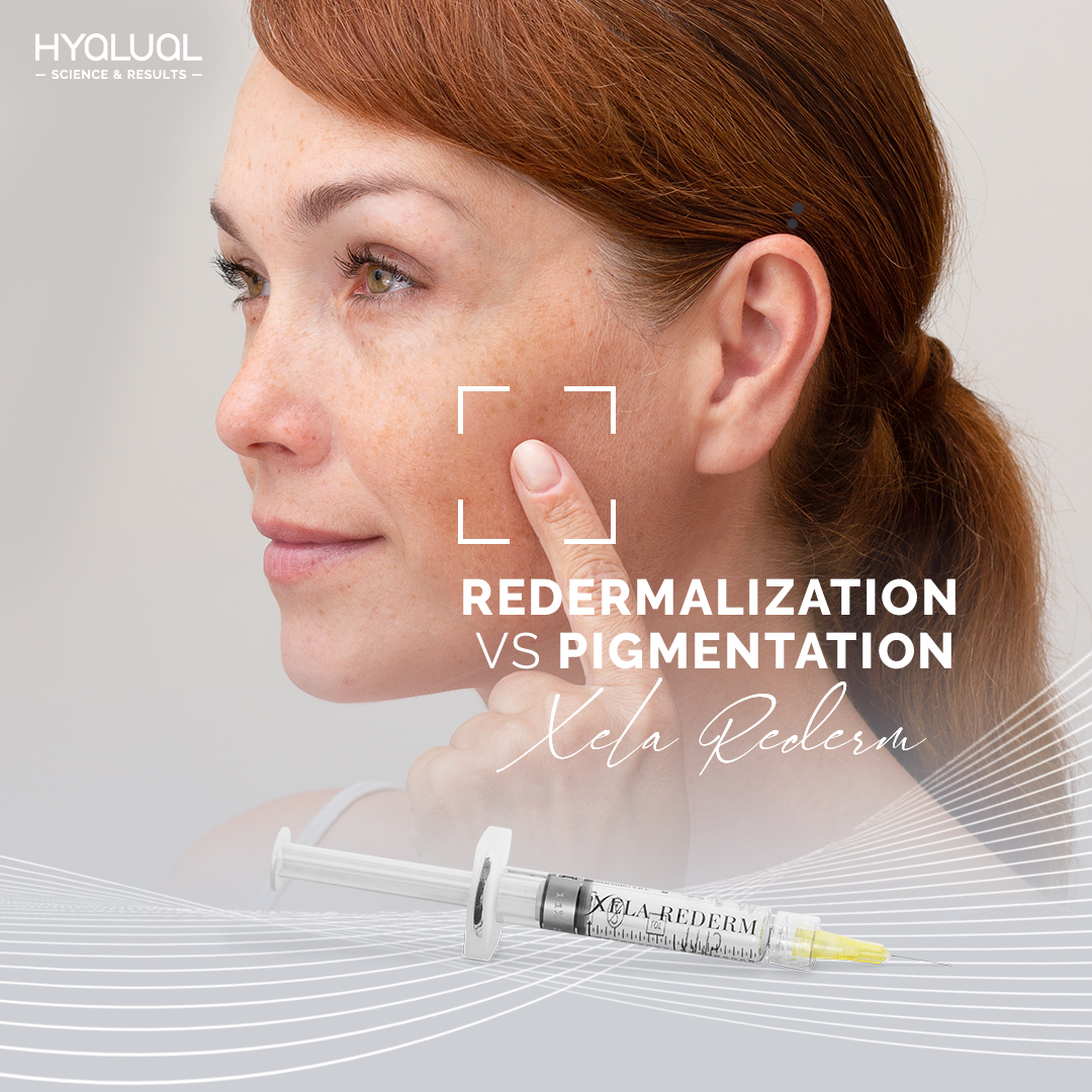 Xela Rederm